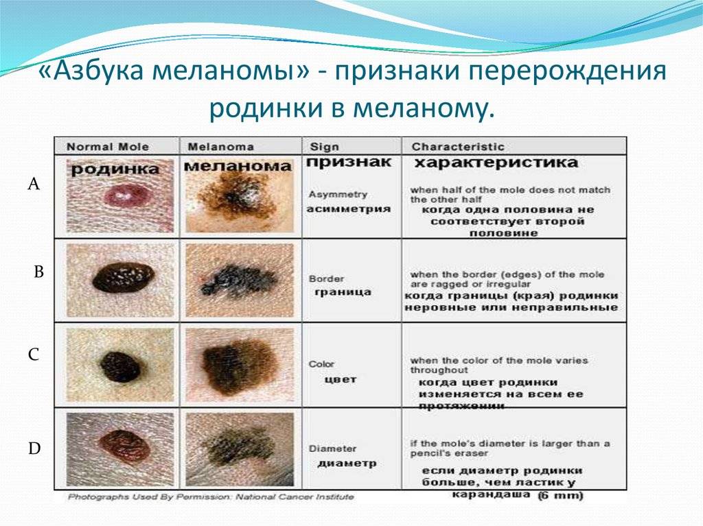 «родинка» ? краткое содержание рассказа михаила шолохова, история создания