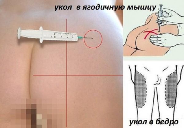 Как обезболить укол ребенку? | акриол про