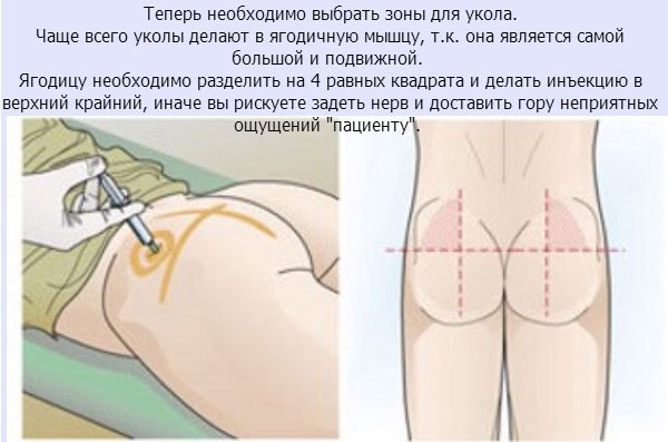 Инъекции новорожденным: как сделать укол младенцу
